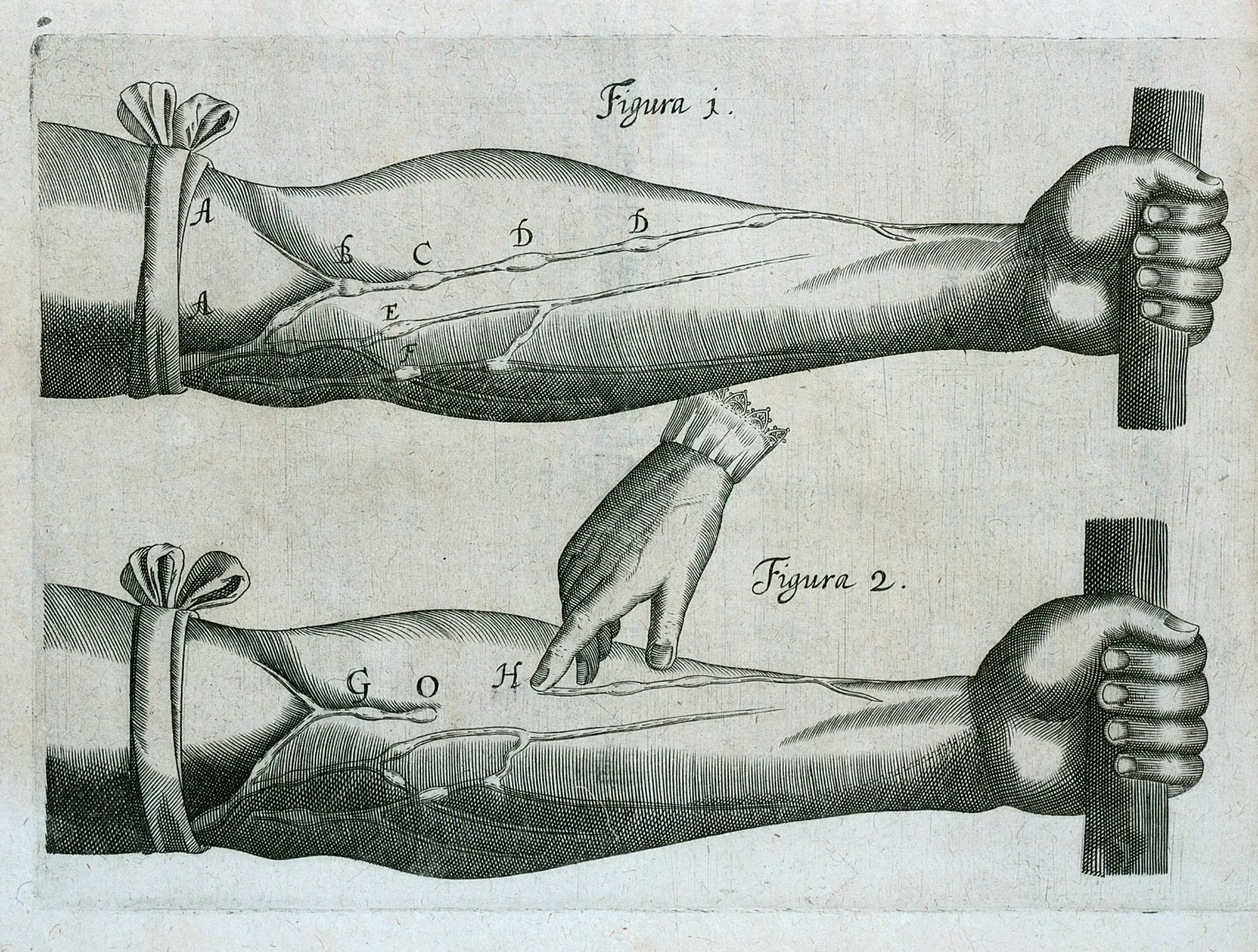 Harvey's figures of a bandaged forearm with swollen veins and valves, from De Motu Cordis.