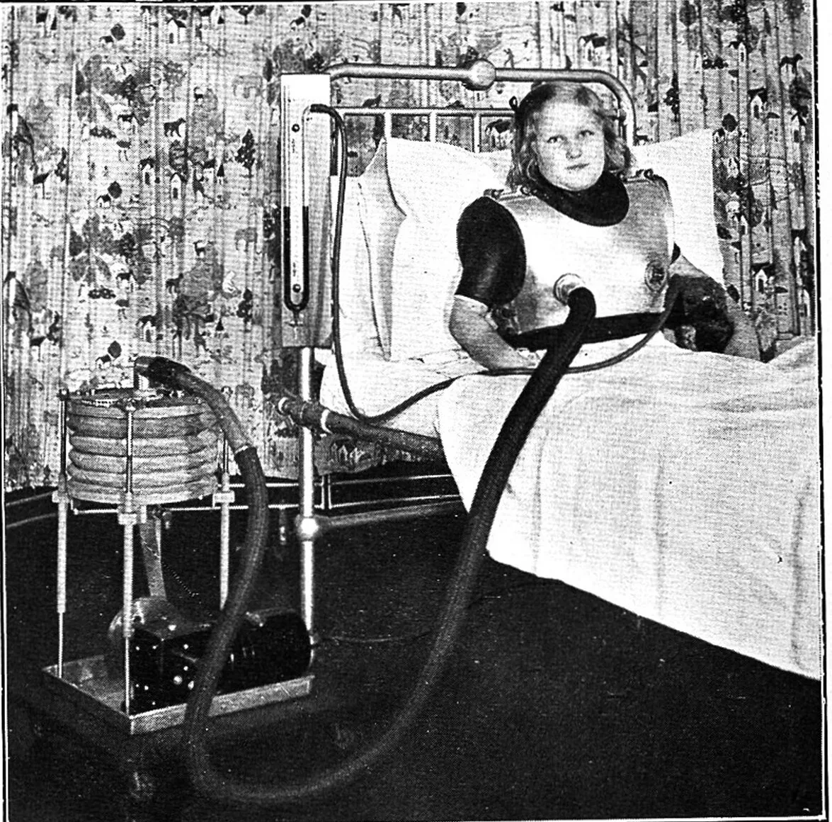 A cuirass respirator, the shell strapped over the chest that did the tank's work for a patient who could sit up. The Blegdam had six of them, and one tank, when the epidemic began. Medical Research Council, 1939 / Wellcome Collection - CC BY 4.0.