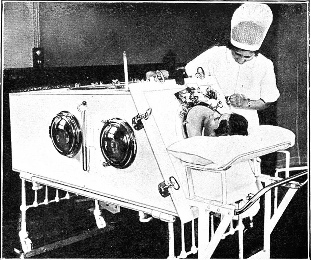 A tank respirator with a nurse at the porthole, from the Medical Research Council's report on "breathing machines," 1939. The pump lowered the pressure around the chest and drew air in through the mouth; in bulbar polio it drew whatever lay in the throat in with it. Medical Research Council, 1939 / Wellcome Collection - CC BY 4.0.