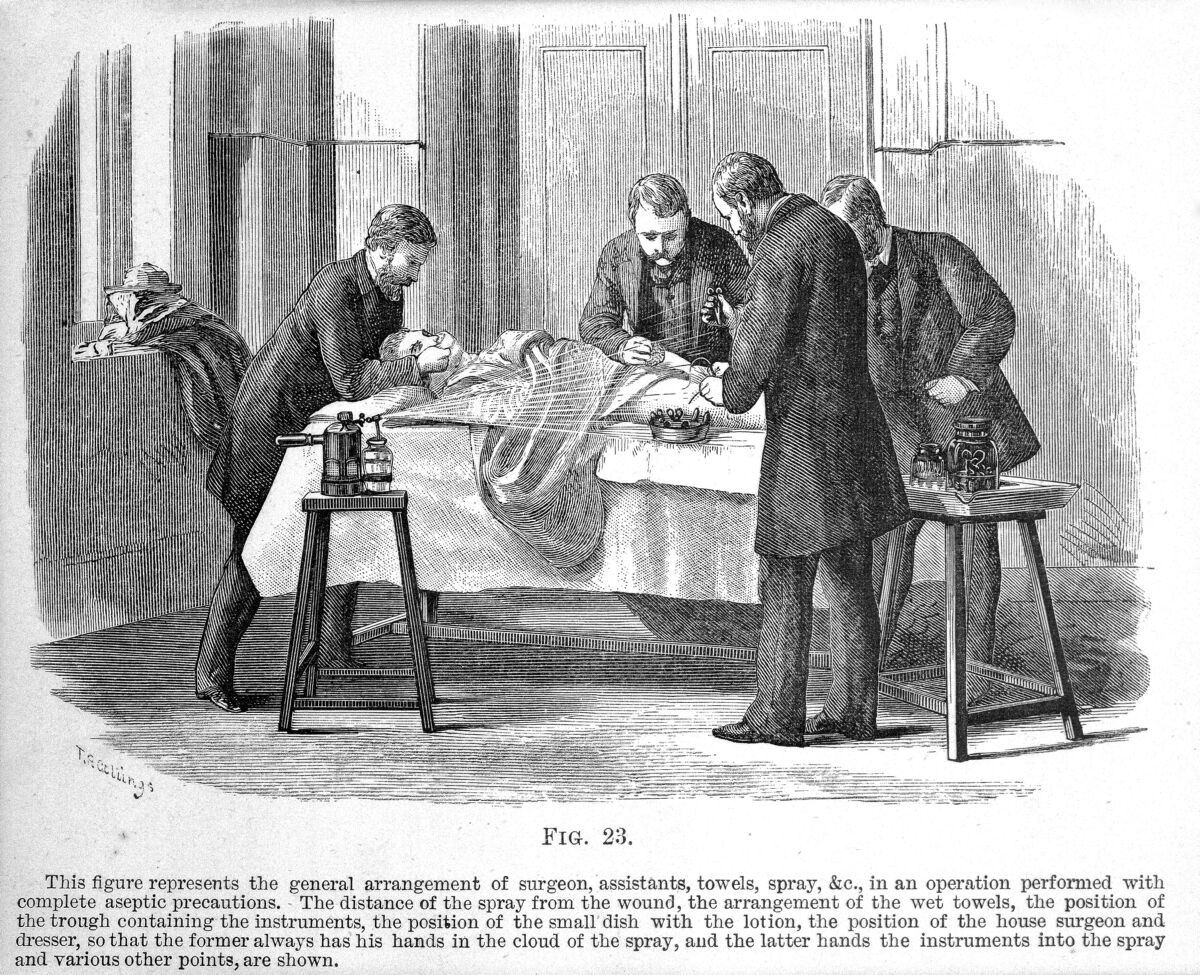 Antiseptic practice at its height, before asepsis made the spray obsolete. Surgeons operating under the Lister carbolic spray; engraving from W. Watson Cheyne, *Antiseptic Surgery* (1882). Wellcome M0003436, CC BY 4.0.