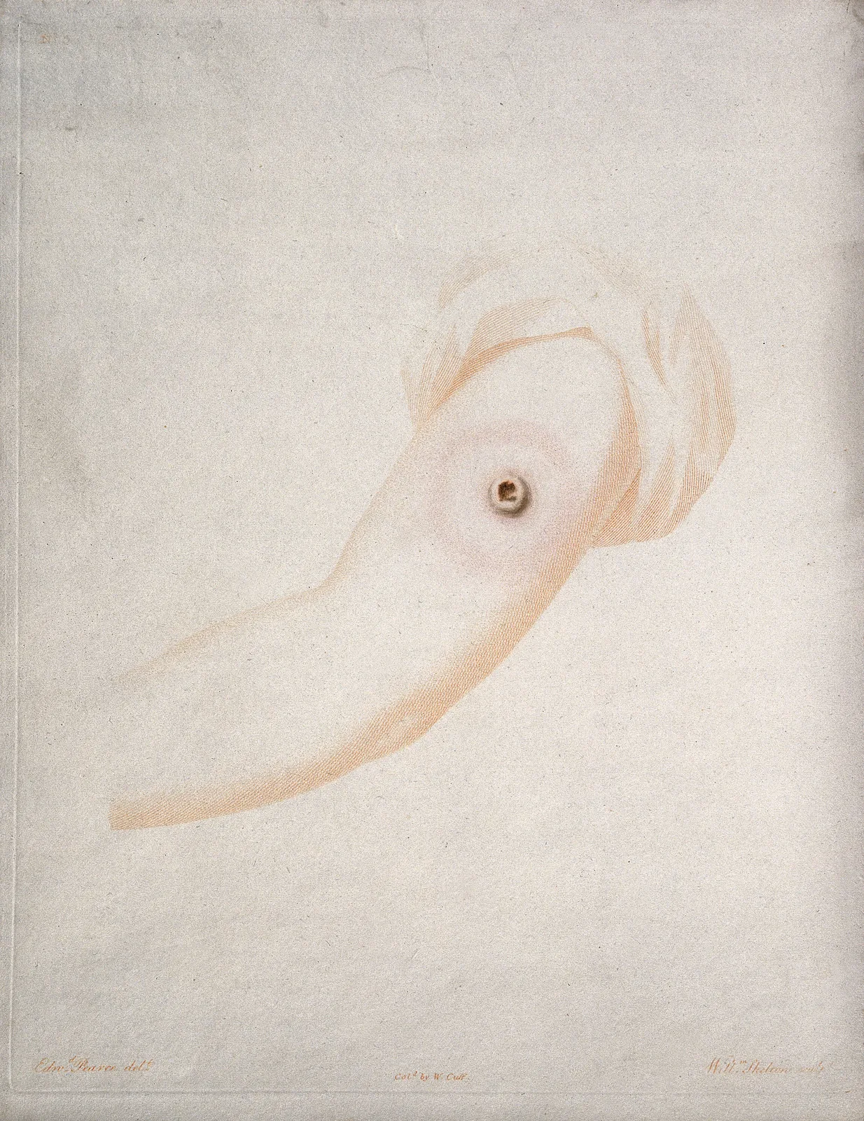 A vaccine pustule on the arm of William Pead, aged eight, after inoculation with cow-pox from another child; coloured etching by W. Cuff and W. Skelton after E. Pearce. Wellcome Collection - Public Domain Mark. WP media **547**.