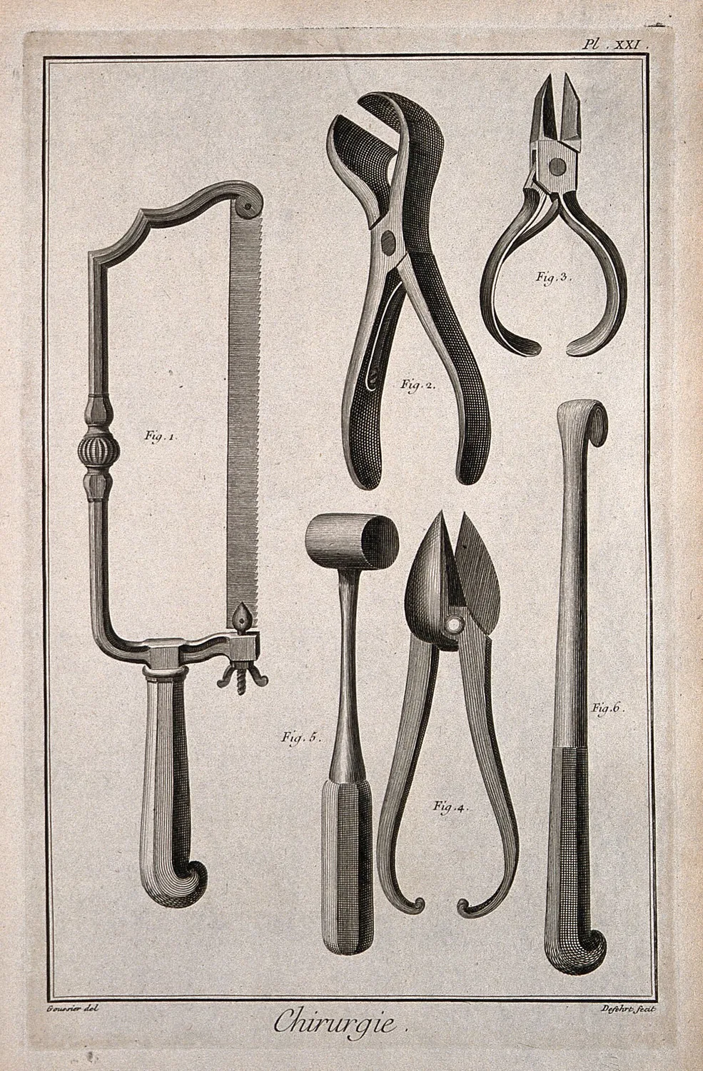 A surgeon's amputation set of the pre-anaesthetic era, built for speed above all. (WP media **593**)